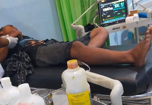 Geng Motor Beraksi di Pantai Labu, Lukai Seorang Remaja