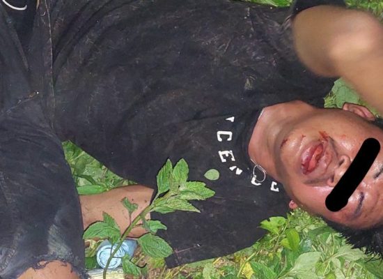 Kaki Seorang Pelaku Ranmor Patah Dihajar Warga