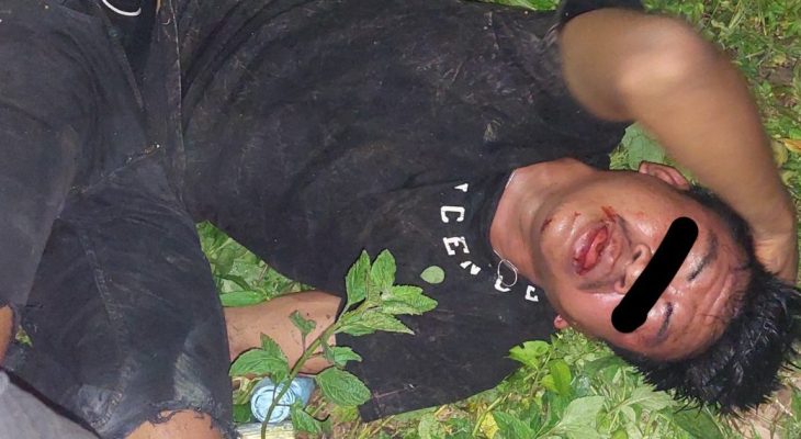 Kaki Seorang Pelaku Ranmor Patah Dihajar Warga