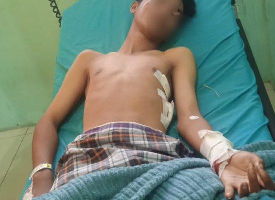 Ngeri! Begal Bersenpi dan Bersajam Berkeliaran di Jalan Sultan Serdang, Tangan Anak Medan Nyaris Putus